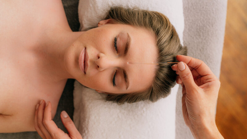 Dry needling terapija by Andrija Rusan